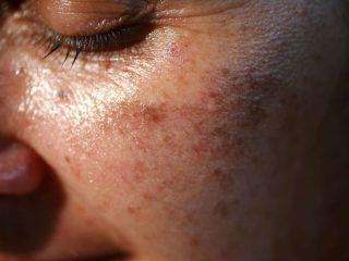 dr lee-mei yap dermatologist melbourne